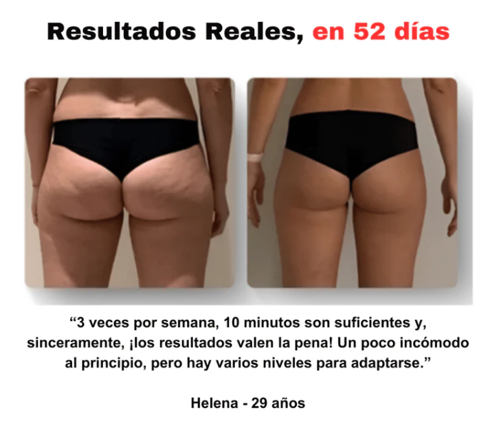 SmoothGlow - Masajeador Anticelulítico| Desintoxica y suaviza la piel