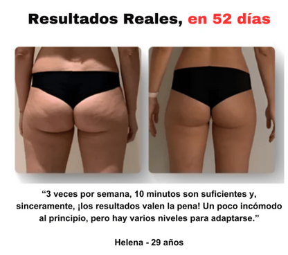 SmoothGlow - Masajeador Anticelulítico| Desintoxica y suaviza la piel