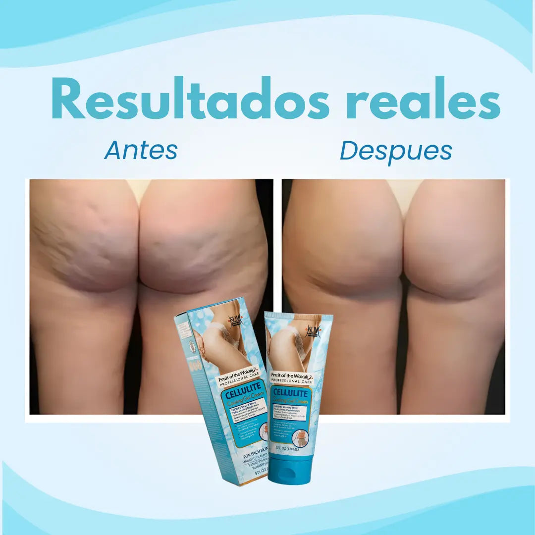 Crema gel anti celulitis